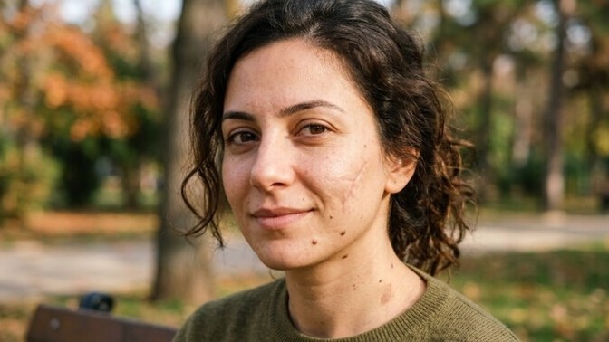 Vücudunuzda veya yüzünüzde dikiş izi, ben ya da doğum lekesi gibi şeyler var mı?
