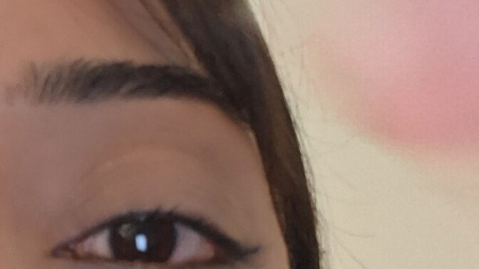 Gözüm sürekli bu şekilde kızarıyor nedeni ne olabilir sizce?