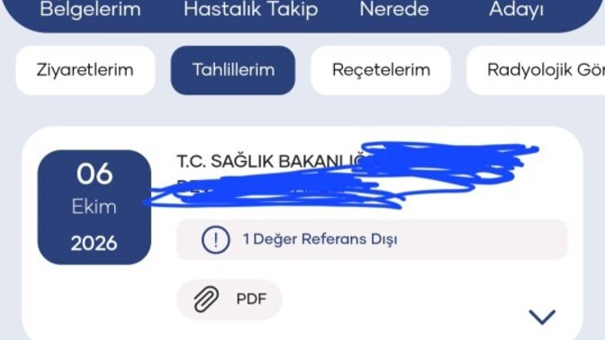 Bişey soracagım bakar mısınız?