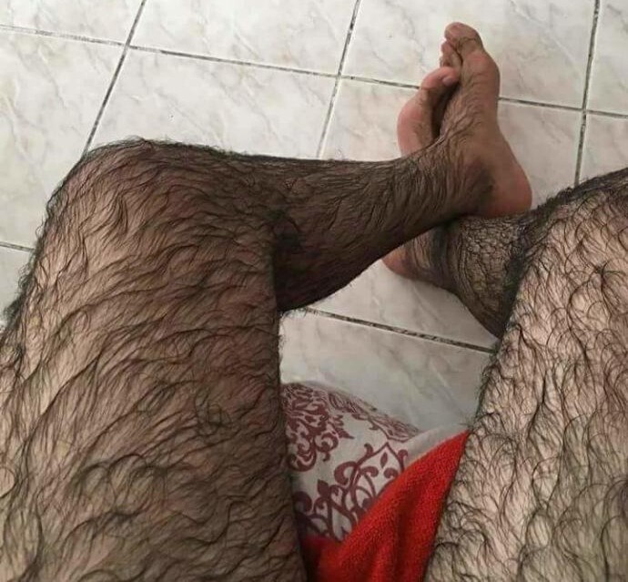 Lazer epilasyon sonrası bacağımda gelişme var mı, nasıl görünüyor?