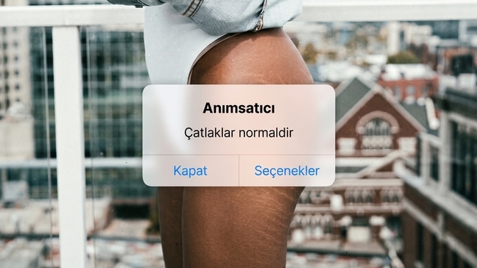 Kadın vücudundaki çatlaklar erkeklere itici mi geliyor? 