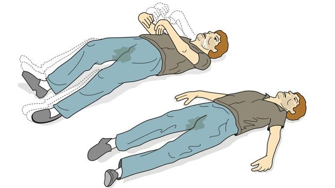 Epilepsi sorunu yaşadınız mı?