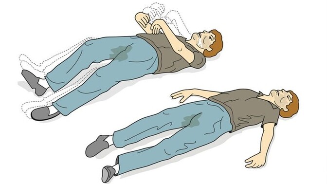 Epilepsi sorunu yaşadınız mı?
