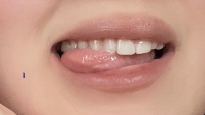 Dişlerinizle barışıkmısınız 🤓?