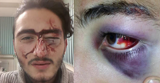 Yediğiniz en efsanevi dayak neydi ?