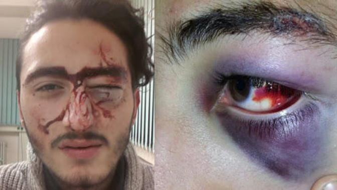 Yediğiniz en efsanevi dayak neydi?