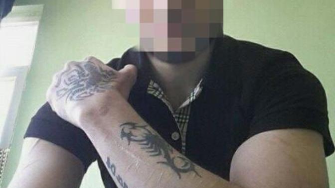 Kollarim kac cm sizce resimli?