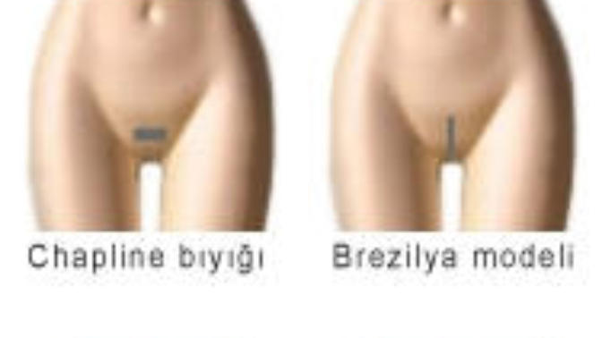 Vagina kıllı mı olsun, kılsız mı?