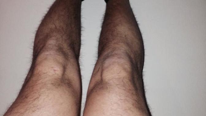 Bakarmısınız bacaklarım çok mu kötü sizce?