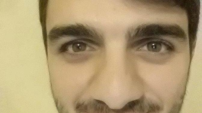 Herkes burnumun buyuk oldugunu söyleyip dalga geçiyor :( :( ?