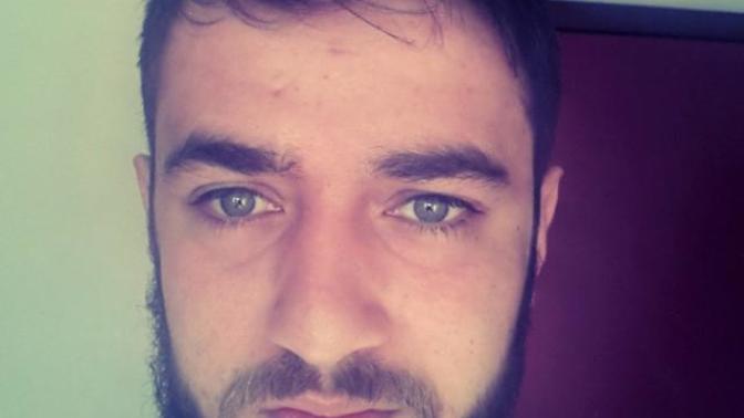 Siyah Sakalım olmasına rağmen bıyıklarım Sarı çıkıyor bu durumu düzeltme imkanım yok mu?