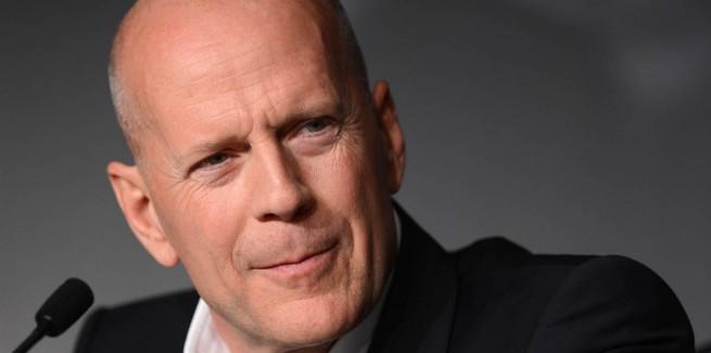 Kel erkekler mi? Sa�� olan erkekler mi?