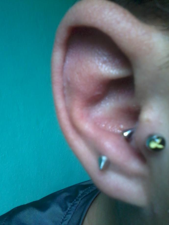 Piercing artık kulağıma girmiyor. Delikmi kapandı yoksa şişkinlik olduğu içinmi?