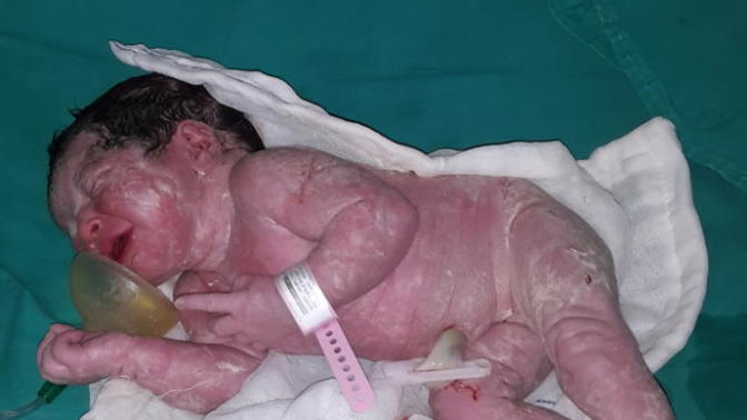 YENİ DOĞAN BEBEK GÖRMEK ister misiniz?