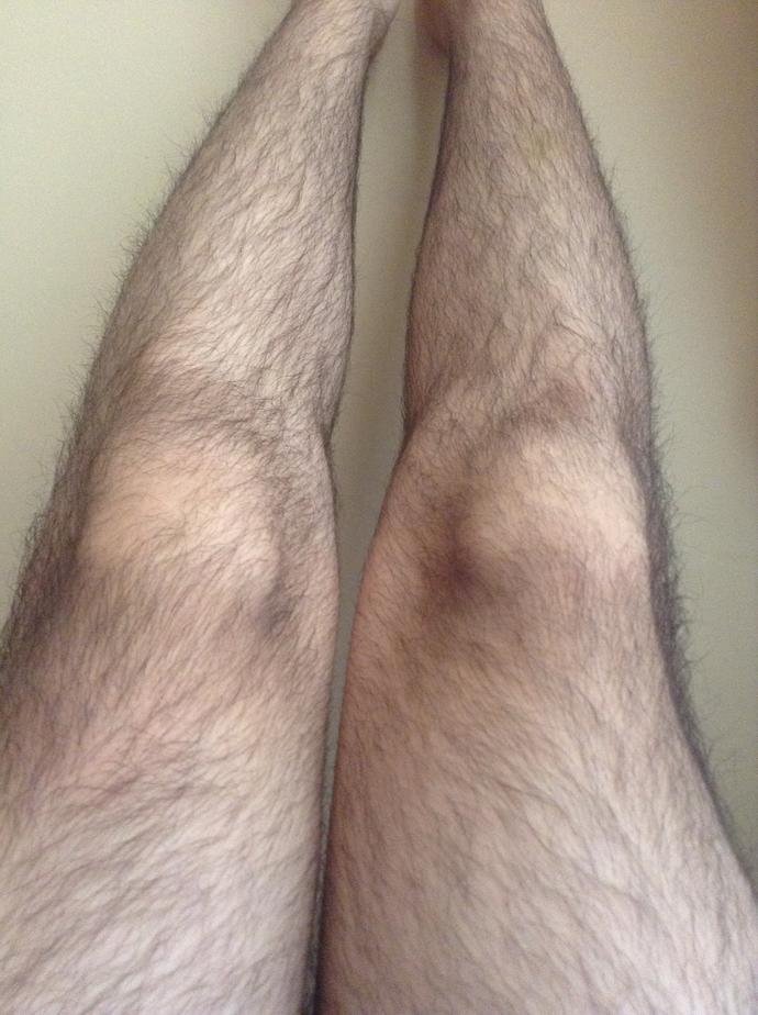 Bacak kıllarım çok mu alsam mı napsam?