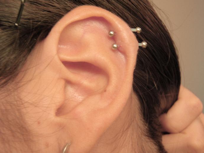 Aranızda piercing kullanıp keloide (et büyümesi) yakalanan var mı?