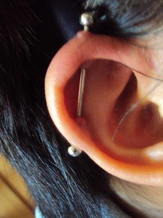 Aranızda piercing kullanıp keloide (et büyümesi) yakalanan var mı?
