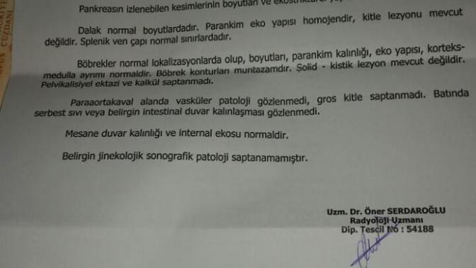 Hepatit b testlerinden anlayan  var mı  bilen varsa bakabilir mi?