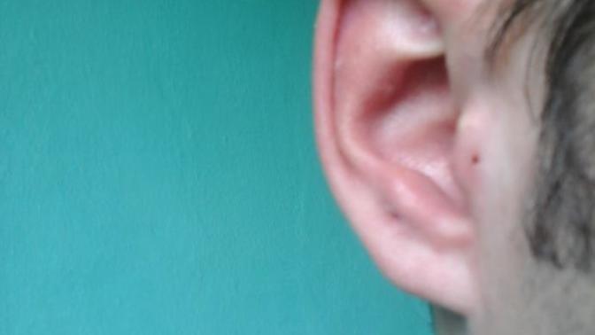 Kulağımın kıkırdak yani üst kısmındaki piercingi keloid nedeniyle çıkardım. Ama hafif bir şişlik var. Bu şişkinlik hiç gitmeyecekmi?
