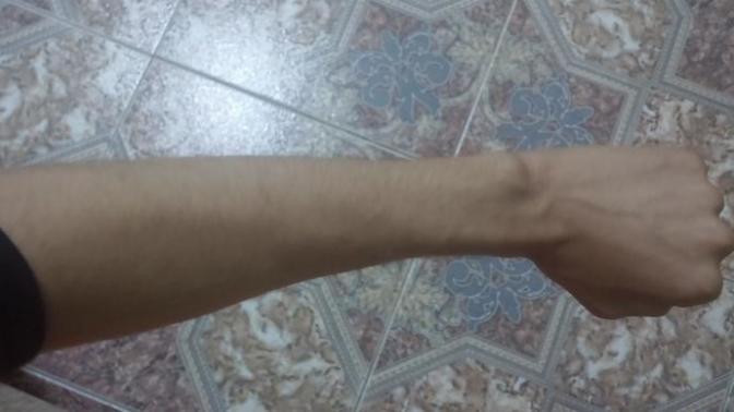 Omuzum kollarim ve bileyim cok ince?
