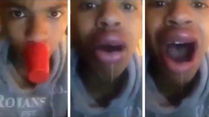 Kylie jenner lip challenge?