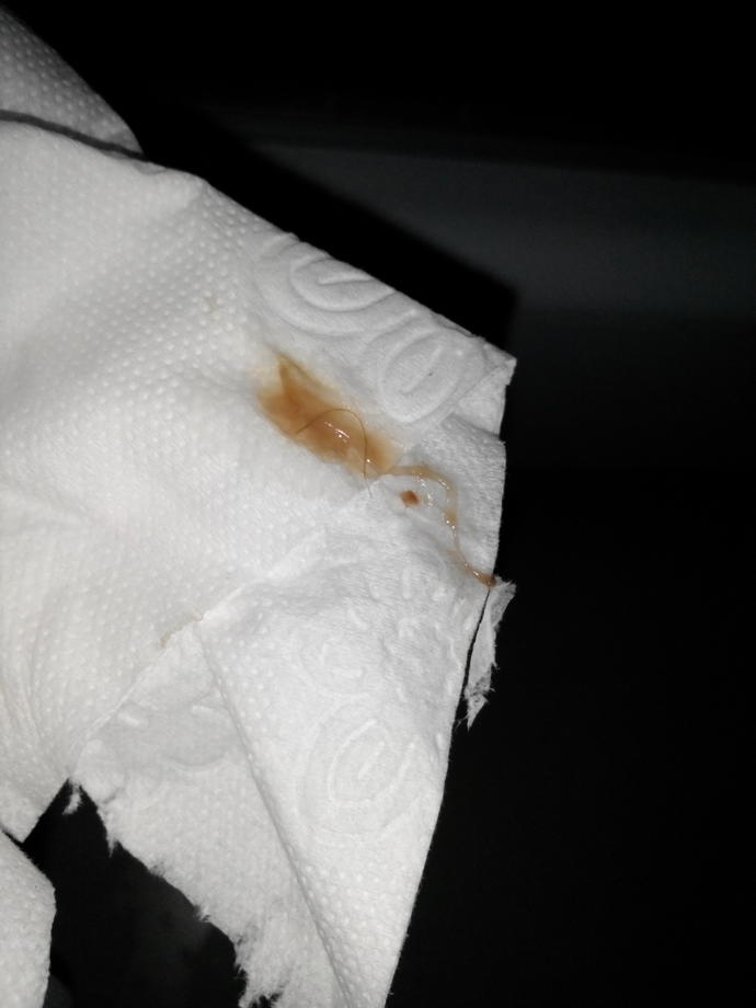 Oncelikle bu igrenc fotograf icin cook cok ozur dilerim fakar .s  Kızlar ovulasyon donemindeyim ve bu renkte akinti geldi bu renk normalmi ?