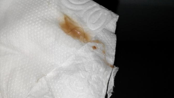 Oncelikle bu igrenc fotograf icin cook cok ozur dilerim fakar. s Kızlar ovulasyon donemindeyim ve bu renkte akinti geldi bu renk normalmi?