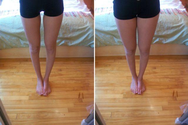 Kızlar thigh gap ne biliyormusunuz sizde var mı thigh gap? erkekler sizde seviyomusunuz sevmiyomusunuz thigh gapı?
