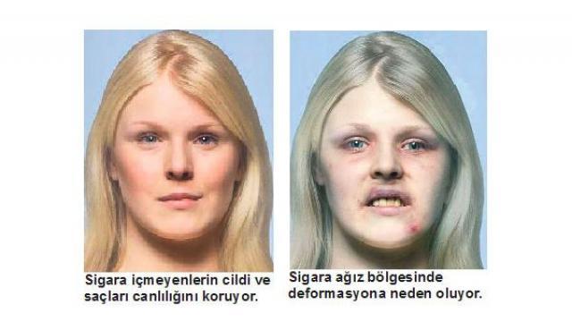 Neden sigara içyorsunuz ?