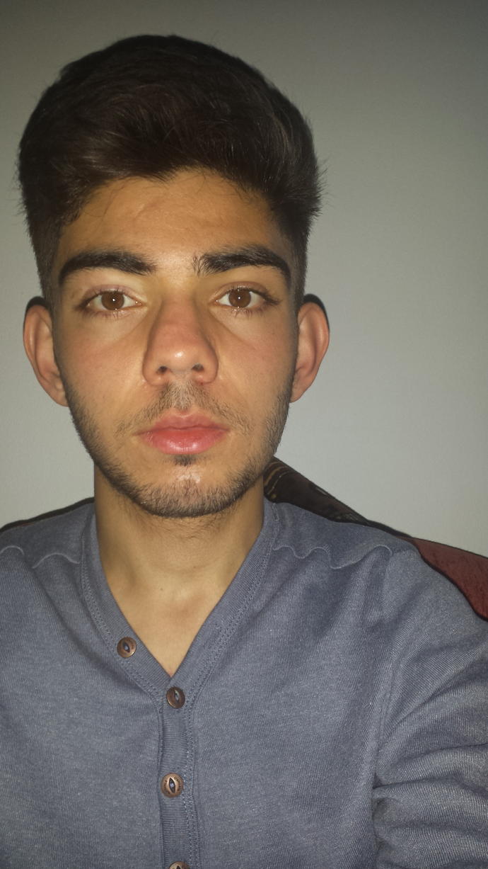 Bu yazin burun estetigi yaptircam?