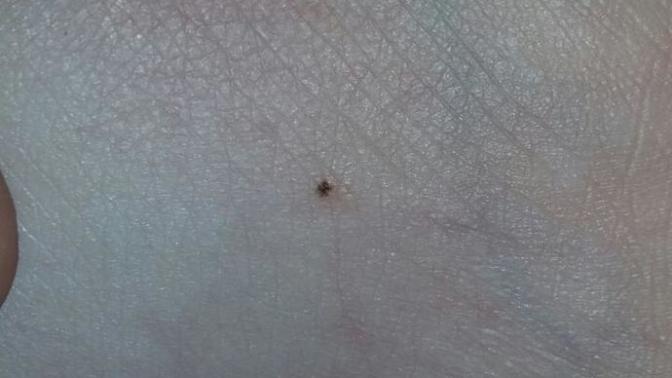 Bu kene mi? arkadaşlar acil cevapp?