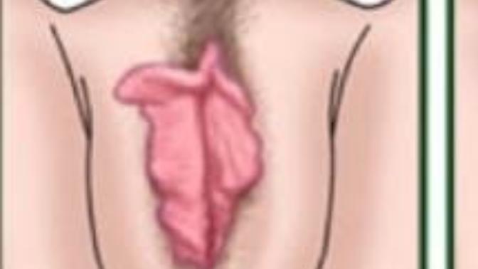 Benim vajina yapım böyle ve bu durumdan nefret ediyorum:(?