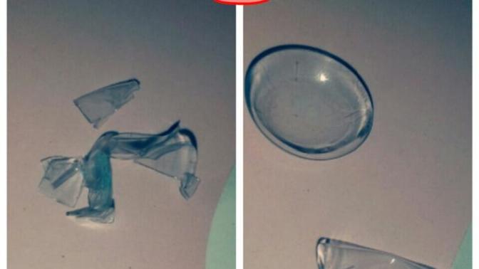 Kontak lens kullanan var mı?
