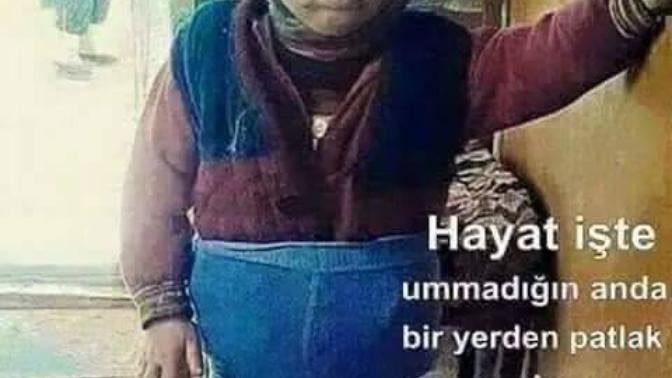 Hayat bu bazen bir yerden patlak veriyor değil mi?