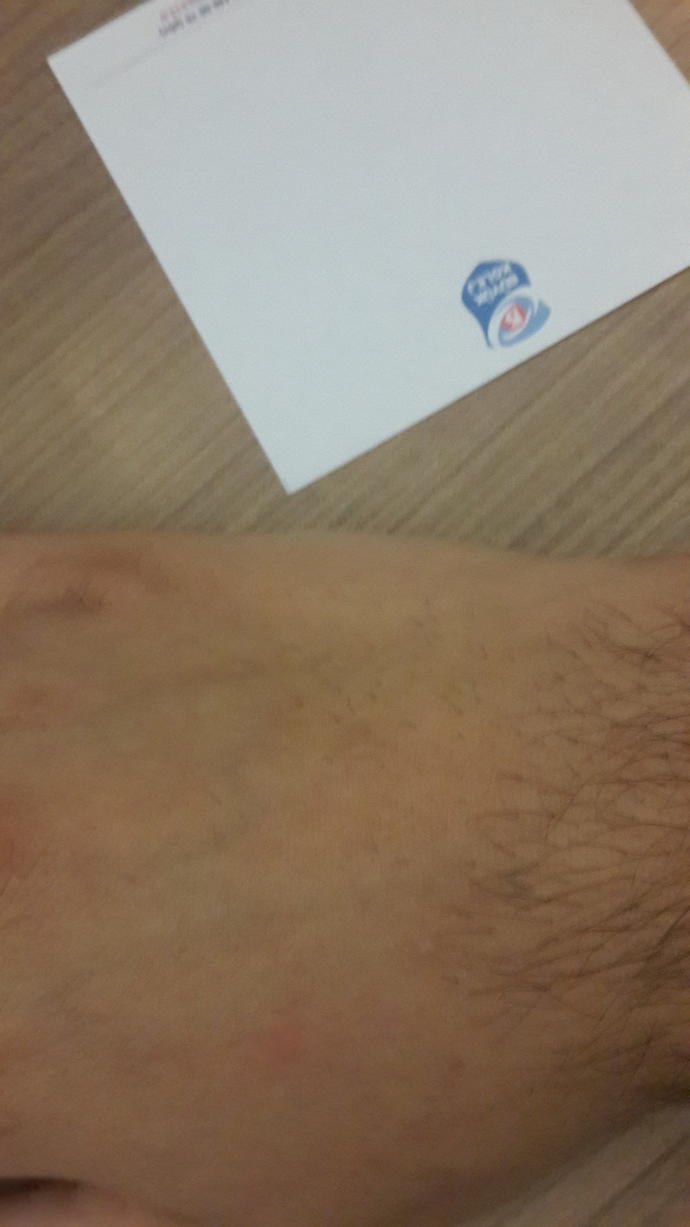 Ağda kılı azaltır mı? Sir ağda değil normal ağda azaltır mı?