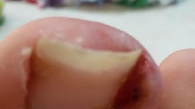 Ayağımda çıkan şeye bakar mısınız :( ?