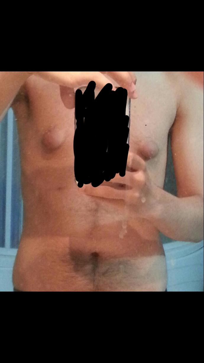 Kızlar lütfen bakın meme uçlarım çok büyük yardım edermisiniz? 