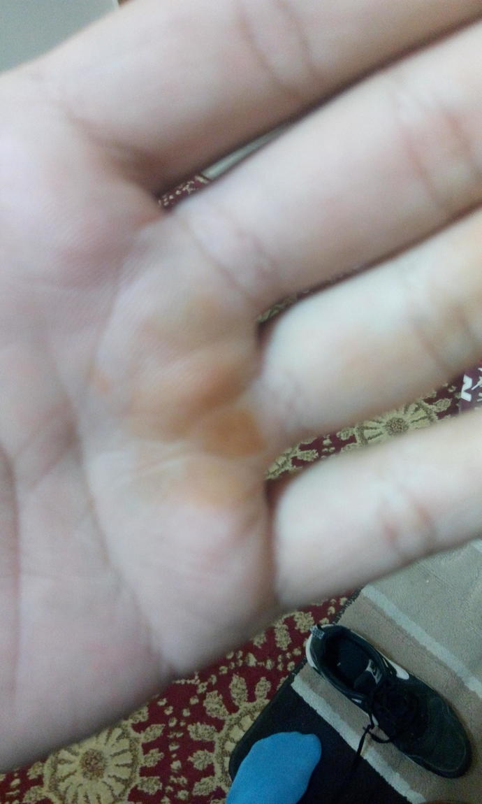 Uyandığımda sol elimde kına çıktı?