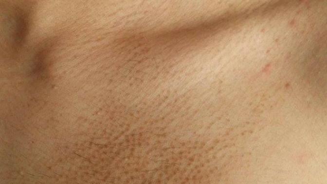 Hastalıgım hakkında bilgisi olan yardım edebilirmi?