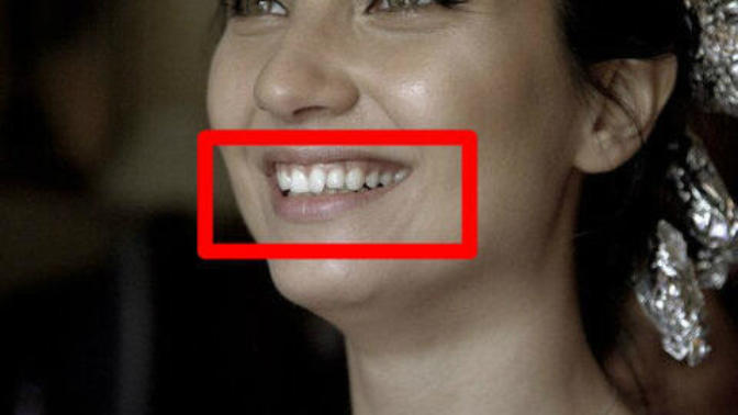 Tuba Büyüküstün ve dişleri? (Resimli) ?