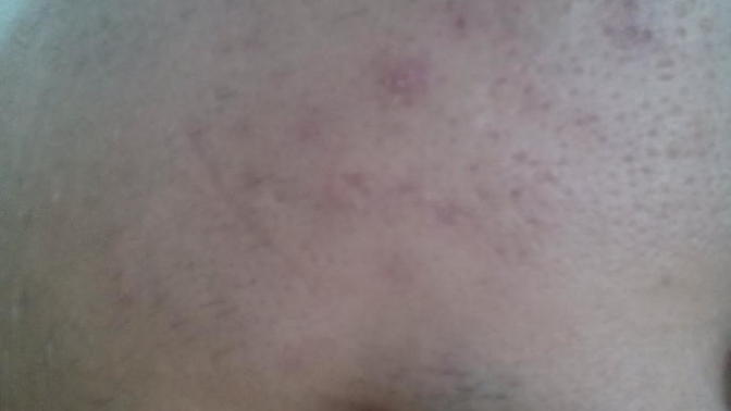 Cildin berbat yardımcı olur musunuz (resimli)?
