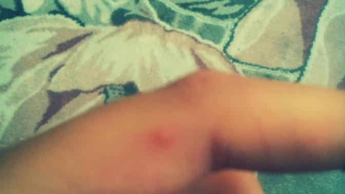Ya  bir  bakar mısınız bu siğil mi acaba?