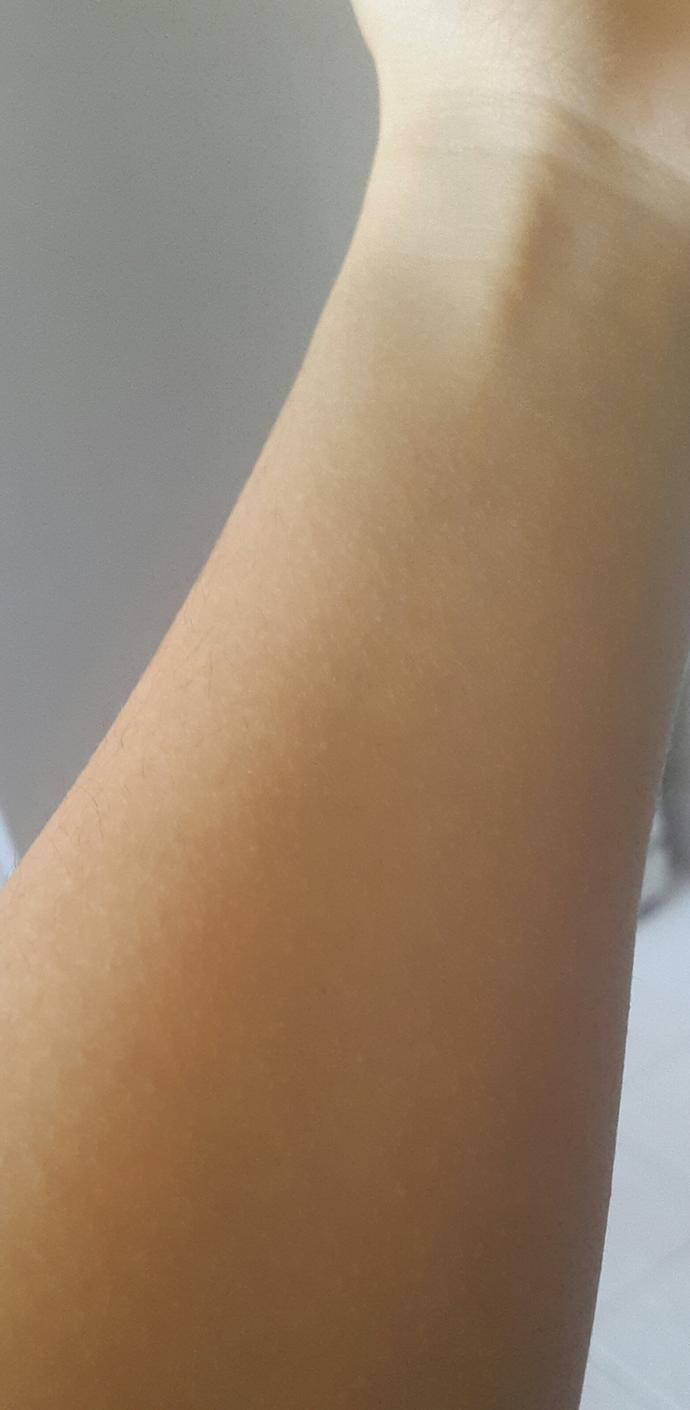 Ten Rengim Ne Renk? Esmer? Buğday? Kumral? Beyaz?