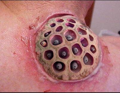 Tripofobisi olan var mı 😨 ?