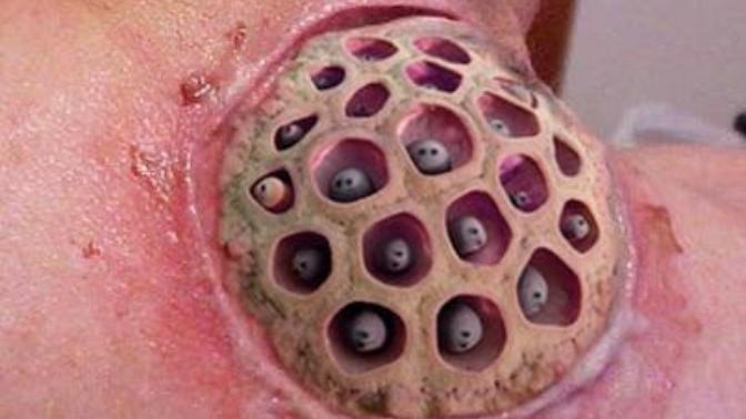Tripofobisi olan var mı 😨 ?