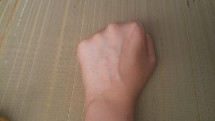 Ellerim damarlı ve ben bundan kurtulamaz mıyım ?