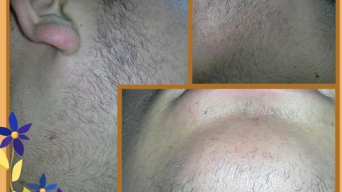 19 YAŞINDAYIM sakalim bu şekilde çıkıyor sizce gürleşirmi foto attım bakarmisiniz?