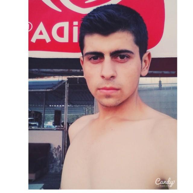 18 yaşındayım ama hiç sakalım yok tüy cıkıyor oda hiç yakışmıyor?
