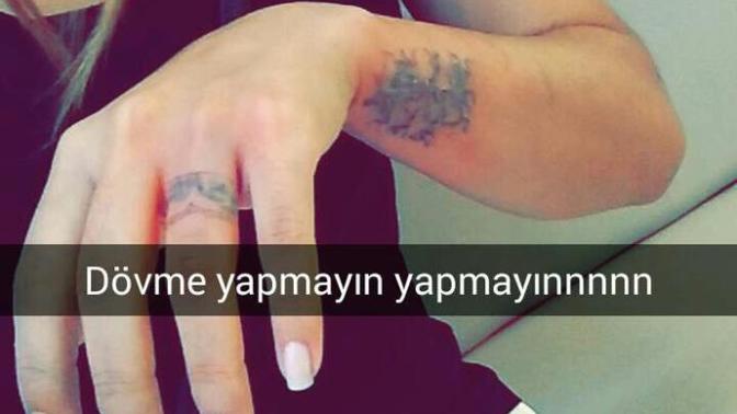 Dövme sildiren var mı? (resimli)?