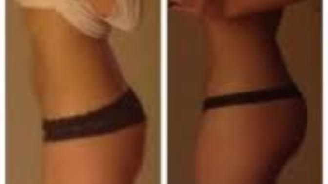 Squat ıle degısım?